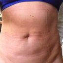 April 9-today I went to Yoga for the first time after lipo and felt great!