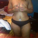 day 9 first time taking pic with panties, visuals make a difference; the strips are falling off seein incision for first time