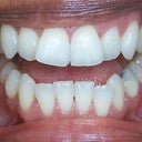 Note my upper right incisor especially.