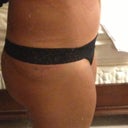 Same day/eve after lipo