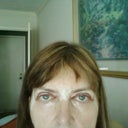 This is 2 hours after my surgery
