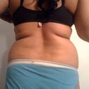 before lipo