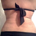 2 weeks after lipo
