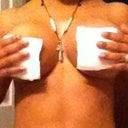 Day 3 post op