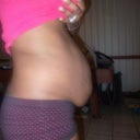 right side view of my stomach before my tummy tuck