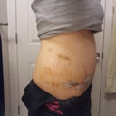 looks a little bit more swollen from this angle compared to day 8... this is day 12