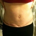 4 1/2 months post op