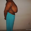 9 Days before surgery..