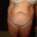 Wow, seeing my stomach like this is hard to stomach.
