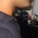 Before. Left side profile. Chin/ Cheeks Full. Connected. Chin protruded forward. And was upturned. Chin Side /Cheek is very close to Lip-End. They actually "meet" then continue flowing harmoniously forward. Crescent moon shape. Chin Tip is very close to Lower Lip. Character. Shape. Sharpness protrusion. Strength.