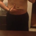 Pre-op