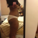 side view pre-op 177lbs i have to get to 150 by May 2013! wish me luck