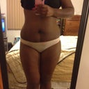 front view pre-op at 177lbs i'm 5 feet 1