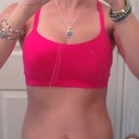 Day 13 post op.