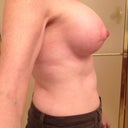 7 wks lateral