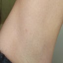 Underarm, has same shadowy hue..looks greenish.