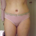 Post Op Day 12 - beginning to take shape :)