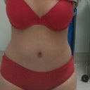 at work swollen 12 wks
