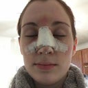 Day 2. Swelling not too bad, feeling pretty good. Nose stopped bleeding so I took off the drip pad.