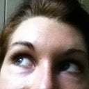 Another DURING TREATMENT photo. This was taken in January 2011. I started having Hyaluronidase half way through 2010. By this stage a lot of the volume had come down. Notice the PURPLE TEAR TROUGH PIGMENTATION. It appeared immediately after commencing hyaluronidase injections. Still there today and makes me look ill, older (like I've been on a Charlie Sheen "bender"). You can't cover this mark with make-up. That just draws attention to it more. Plus the make-up cakes in my under eye folds. I never even needed concealer or any make-up before all this happended. Gone are the days where I look young, vibrant and healthy.