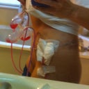 Day 2 Post op