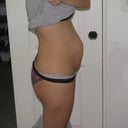 day before surgery
