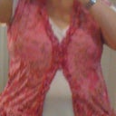 3 weeks post Op - I have titties ! Surgery was 29-AUG-2012
