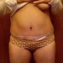 stitchless belly button.  sorry for the boobie shot.