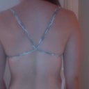 3 weeks post op, can't believe this is all that's holding up my girls!