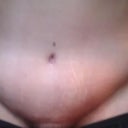 what happened? :( swollen hurting 1 month PO * this was taken prior to draining a very large seroma that developed at 4 weeks