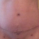 5 Week PO!! Healing nicely I think!