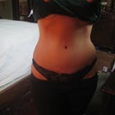 2011 - 5 months post op