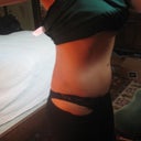 2011 - 5 months post op