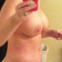 5 weeks post op