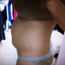 Before-another side view