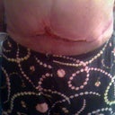 Another one Closer up. You can see where the hard parts are in my abdomen as they bulge