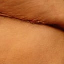 left side skin ripples and another sore spot