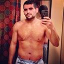 7 days post op