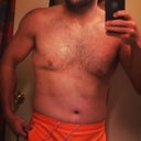 10 days post op!