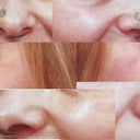 before , essay from surgeon