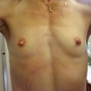 Before