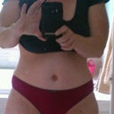 Two weeks post op.  Now THATS BETTER!
