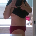 Two weeks post-op.  Still swollen.  I'll get there!