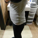 11 Days PO Swelling.. I look 6 months pregnant in clothes..