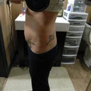 11 Days PO swelling so bad..