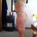 2 months P/O Left side