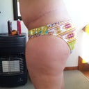 2 months P/O left side scar