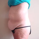 another pre surgery. july 2011