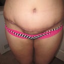 5wks swollen belly, nasty scar so far. belly button is chill.