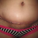 front view of my belly button. it is what is it!
